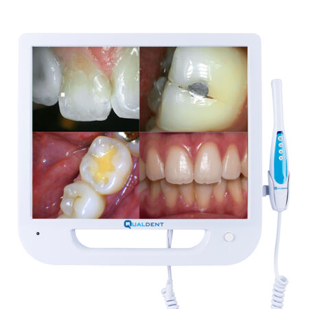 Qualdent Intra Oral Camera with Screen - Classic
