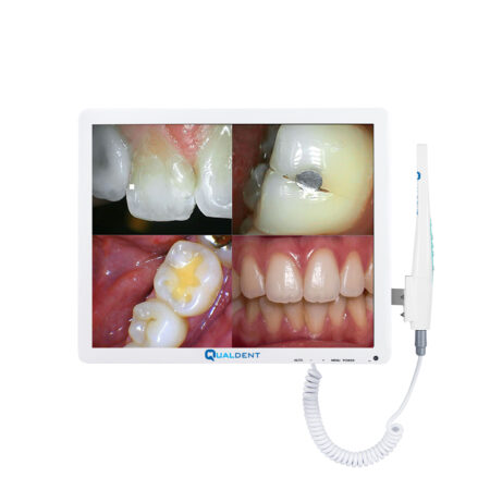 Qualdent Intraoral Camera Super-Cam with PMS